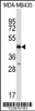 Western blot analysis in MDA-MB435 cell line lysates (35ug/lane) .