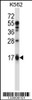 Western blot analysis in K562 cell line lysates (35ug/lane) .