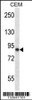 Western blot analysis in CEM cell line lysates (35ug/lane) .