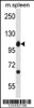 Western blot analysis in mouse spleen tissue lysates (35ug/lane) .