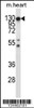 Western blot analysis in mouse heart tissue lysates (35ug/lane) .