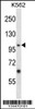 Western blot analysis in K562 cell line lysates (35ug/lane) .