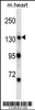 Western blot analysis in mouse heart tissue lysates (35ug/lane) .