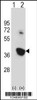 Western blot analysis of Nek6 using rabbit polyclonal Mouse Nek6 Antibody using 293 cell lysates (2 ug/lane) either nontransfected (Lane 1) or transiently transfected (Lane 2) with the Nek6 gene.