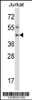 Western blot analysis in Jurkat cell line lysates (35ug/lane) .