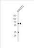 Western blot analysis of lysate from mouse NIH/3T3 cell line, using Mouse Ntrk2 Antibody at 1:1000 at each lane.