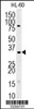 Western blot analysis in HL-60 cell line lysates (35ug/lane) .