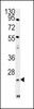 Western blot analysis in mouse Neuro-2a cell line lysates (35ug/lane) .