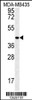 Western blot analysis in MDA-MB435 cell line lysates (35ug/lane) .