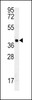 Western blot analysis in MDA-MB435 cell line lysates (35ug/lane) .