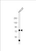 Western Blot at 1:1000 dilution + HACAT whole cell lysate Lysates/proteins at 20 ug per lane.