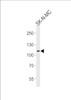 Western blot analysis of lysate from SK-N-MC cell line, using NOC3L Antibody at 1:1000 at each lane.