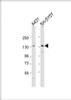 Western Blot at 1:2000 dilution Lane 1: A431 whole cell lysate Lane 2: SH-SY5Y whole cell lysate Lysates/proteins at 20 ug per lane.