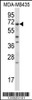 Western blot analysis in MDA-MB435 cell line lysates (35ug/lane) .