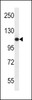 Western blot analysis in ZR-75-1 cell line lysates (35ug/lane) .