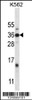 Western blot analysis in K562 cell line lysates (35ug/lane) .