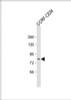 Western Blot at 1:500 dilution + CCRF-CEM whole cell lysate Lysates/proteins at 20 ug per lane.