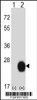 Western blot analysis of CSRP2 using rabbit polyclonal CSRP2 Antibody using 293 cell lysates (2 ug/lane) either nontransfected (Lane 1) or transiently transfected (Lane 2) with the CSRP2 gene.