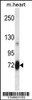 Western blot analysis in mouse heart tissue lysates (35ug/lane) .