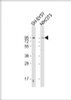 Western Blot at 1:2000 dilution Lane 1: SH-SY5Y whole cell lysate Lane 2: NIH/3T3 whole cell lysate Lysates/proteins at 20 ug per lane.