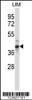 Western blot analysis in human uterine tumor tissue lysates (35ug/lane) .