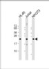 Western Blot at 1:2000 dilution Lane 1: HL-60 whole cell lysate Lane 2: Jurkat whole cell lysate Lane 3: NIH/3T3 whole cell lysate Lysates/proteins at 20 ug per lane.