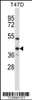 Western blot analysis in T47D cell line lysates (35ug/lane) .