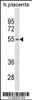 Western blot analysis in human placenta tissue lysates (35ug/lane) .