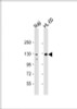 Western Blot at 1:2000 dilution Lane 1: Raji whole cell lysate Lane 2: HL-60 whole cell lysate Lysates/proteins at 20 ug per lane.