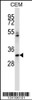 Western blot analysis in CEM cell line lysates (35ug/lane) .