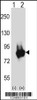 Western blot analysis of Prkd3 using rabbit polyclonal Mouse Prkd3 Antibody using 293 cell lysates (2 ug/lane) either nontransfected (Lane 1) or transiently transfected (Lane 2) with the Prkd3 gene.