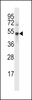 Western blot analysis in MDA-MB231 cell line lysates (35ug/lane) .