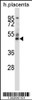 Western blot analysis in human placenta tissue lysates (35ug/lane) .This demonstdetected the GRAMD3 protein (arrow) .