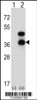 Western blot analysis of CD72 using rabbit polyclonal CD72 Antibody using 293 cell lysates (2 ug/lane) either nontransfected (Lane 1) or transiently transfected (Lane 2) with the CD72 gene.