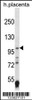 Western blot analysis in human placenta tissue lysates (35ug/lane) .