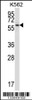 Western blot analysis in K562 cell line lysates (35ug/lane) .
