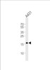 Western blot analysis of lysate from A431 cell line, using DUT Antibody at 1:1000 at each lane.