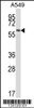 Western blot analysis in A549 cell line lysates (35ug/lane) .