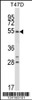 Western blot analysis in T47D cell line lysates (35ug/lane) .