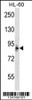 Western blot analysis in HL-60 cell line lysates (35ug/lane) .