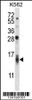 Western blot analysis in K562 cell line lysates (35ug/lane) .