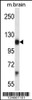 Western blot analysis in mouse brain tissue lysates (35ug/lane) .