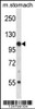 Western blot analysis in mouse stomach tissue lysates (35ug/lane) .