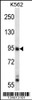 Western blot analysis in K562 cell line lysates (35ug/lane) .