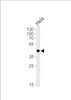 Western blot analysis of lysate from Hela cell line, using Mouse Mapkapk3 Antibody at 1:1000.