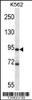 Western blot analysis in K562 cell line lysates (35ug/lane) .