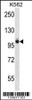 Western blot analysis in K562 cell line lysates (35ug/lane) .