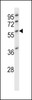 Western blot analysis in HL-60 cell line lysates (35ug/lane) .This demonstrates the DES antibody detected the DES protein (arrow) .