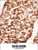 DES/Desmin (Muscle Cell Marker) Antibody immunohistochemistry analysis in formalin fixed and paraffin embedded human heart tissue followed by peroxidase conjugation of the secondary antibody and DAB staining.This data demonstrates the use of DES/Desmin (Muscle Cell Marker) Antibody for immunohistochemistry.