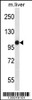 Western blot analysis in mouse liver tissue lysates (35ug/lane) .